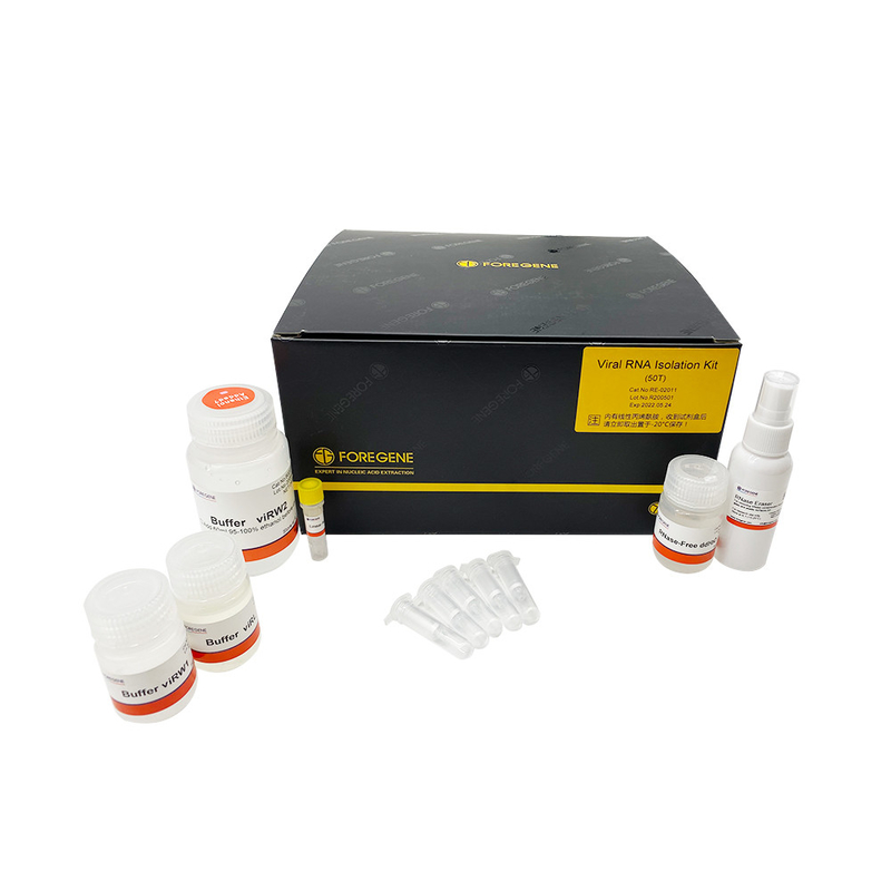 200 Stukken van de Uitrustingenrn-ase van de RNAisolatie van de RNA slechts Kolom Vrij Hoog RNAmirna isolation kits from serum 200ul